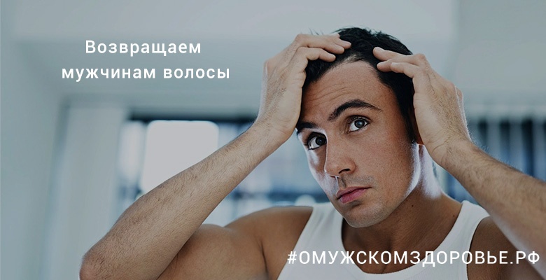 Возвращаем мужчинам волосы