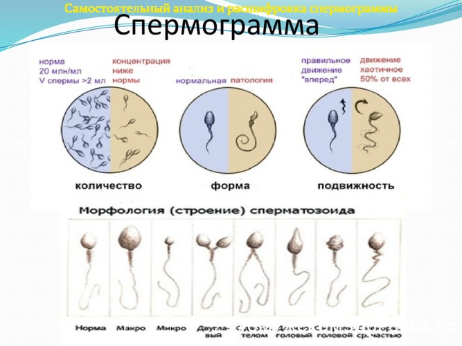 Нормы и нарушения в спермограмме